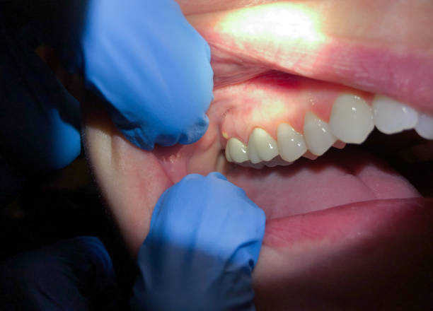 Professional Emergency Dental Service in NE